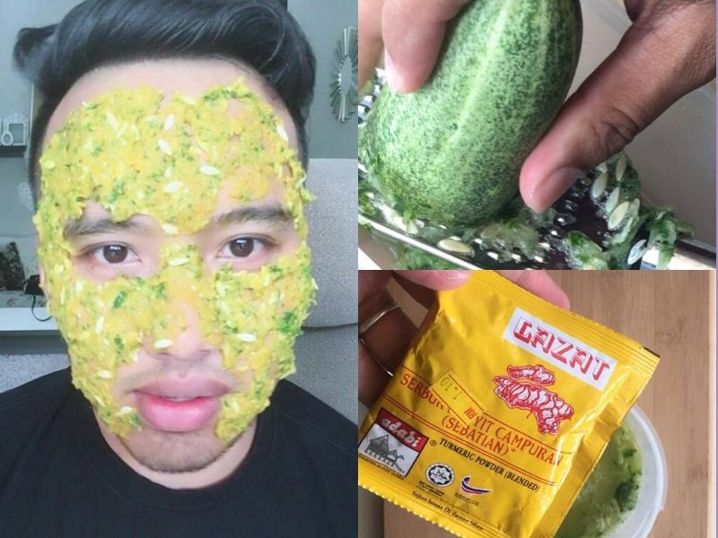 menghilangkan bekas jerawat